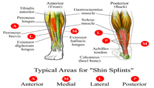 Shin Splints (Shin Pain) - Foot Bio Tec